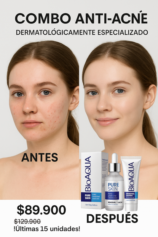 COMBO ANTI-ACNE BIOAQUA ESPECIALIZADO